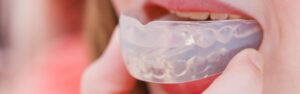 4-super-reasons-why-you-should-wear-a-custom-mouthguard-while-playing-basketball-1920x600-1.jpg  