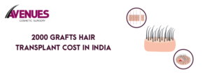 2000-Grafts-Hair-Transplant-Cost-in-India.png  