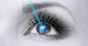 bw-eye-aqua-laser-1200x630-1024x538.jpg  