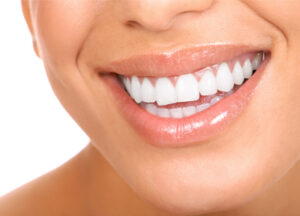teeth whitening - no gap dentists - sydney.jpg  